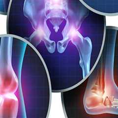 Exploring the Various Types of Arthritis Therapy: A Comprehensive Overview