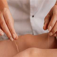 Exploring Acupuncture as an Effective Therapy for Arthritis