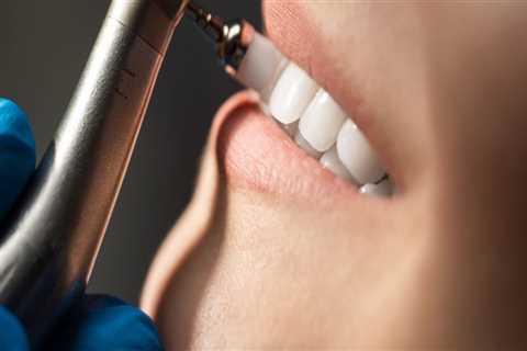 The Essential Benefits of Regular Teeth Cleaning for Optimal Oral Health