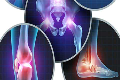 Exploring the Various Types of Arthritis Therapy: A Comprehensive Overview