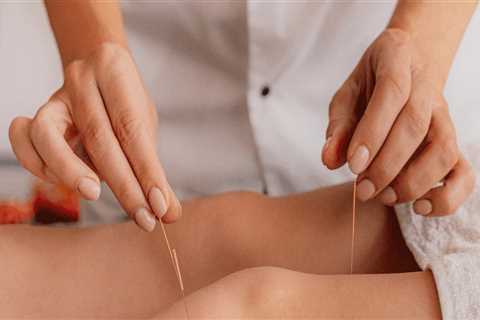 Exploring Acupuncture as an Effective Therapy for Arthritis