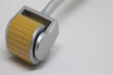 Microneedling in Zürich, Switzerland and the Modern Medical Spa Experience
