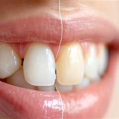 Why Smile Makeovers Are About More Than Cosmetic Enhancements