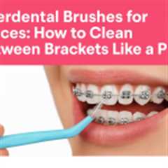 Interdental Brushes for Braces: How to Clean Between Brackets Like a Pro