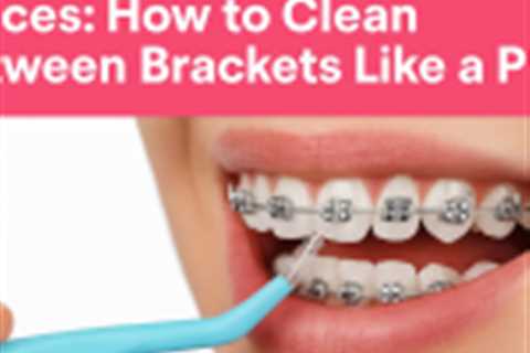 Interdental Brushes for Braces: How to Clean Between Brackets Like a Pro